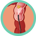 Colonoscopia