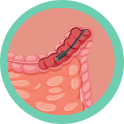 Sigmoidoscopia