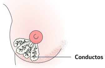 Cáncer de seno invasivo