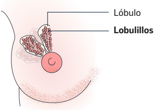 Cáncer de seno invasivo