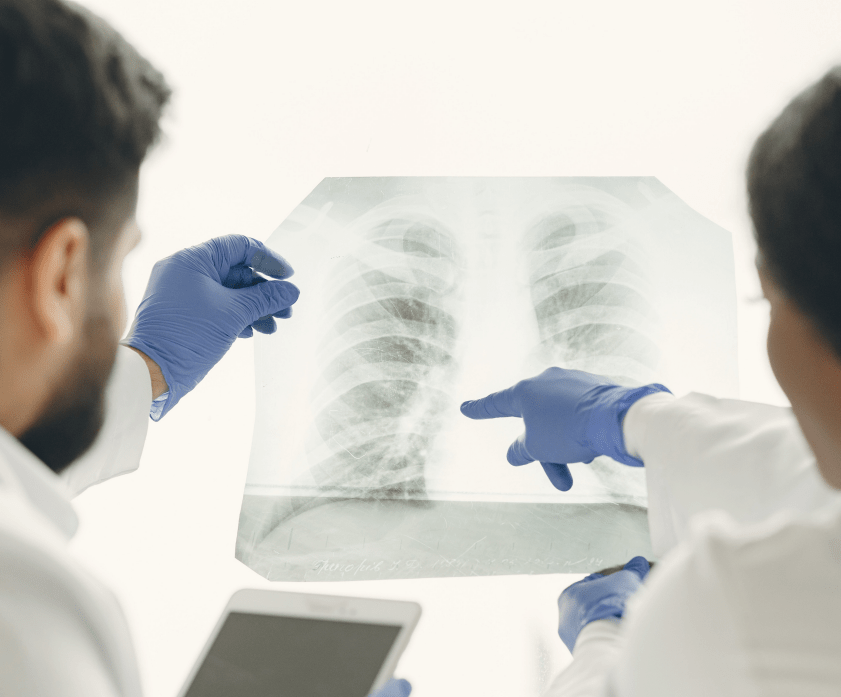 Detección temprana de cáncer de pulmón