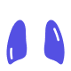 Cáncer de pulmón.