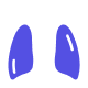 Cáncer de pulmón