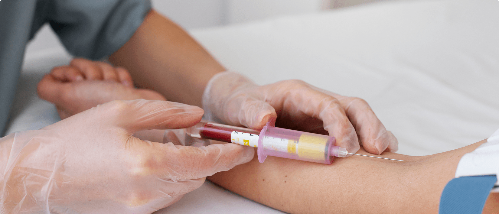 Pruebas de biomarcadores. Cáncer en la sangre.