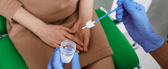 Prueba de Papanicolaou (PAP) para detectar el cáncer de cuello uterino.