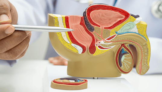 Exámenes para detectar el cáncer de próstata.
