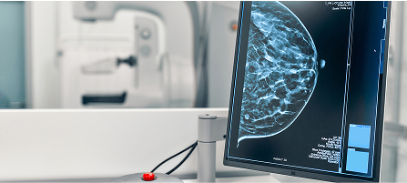 Mamografía
