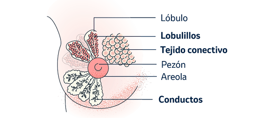 Imagen descriptiva del cáncer de mama
